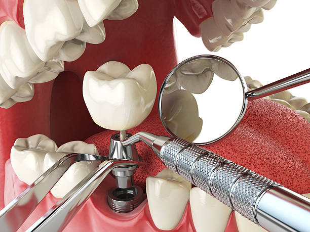 Best Emergency Dental Extractions in Adrian, MO